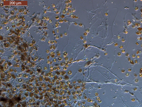 Magnified images of Lindivia intermedia in water samples from North Mavora Lake.